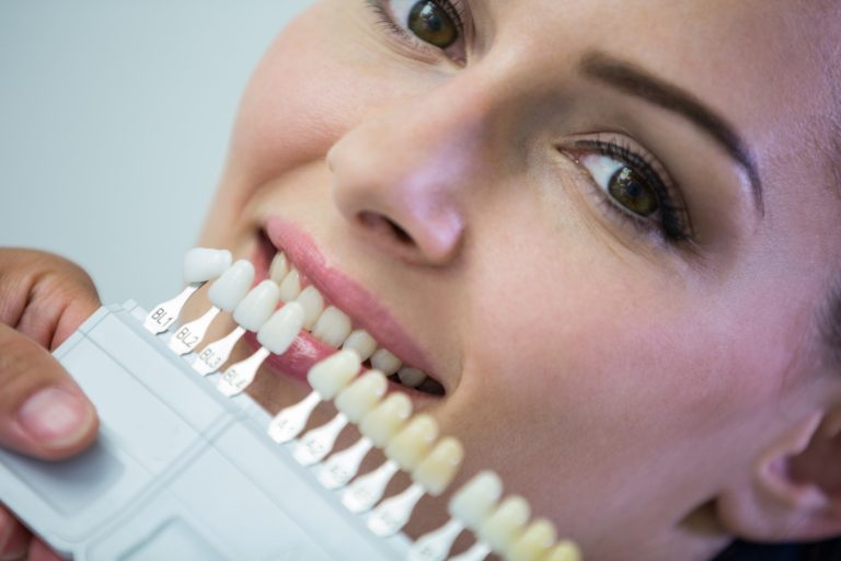 Innovación en implantes dentales transforma sonrisas